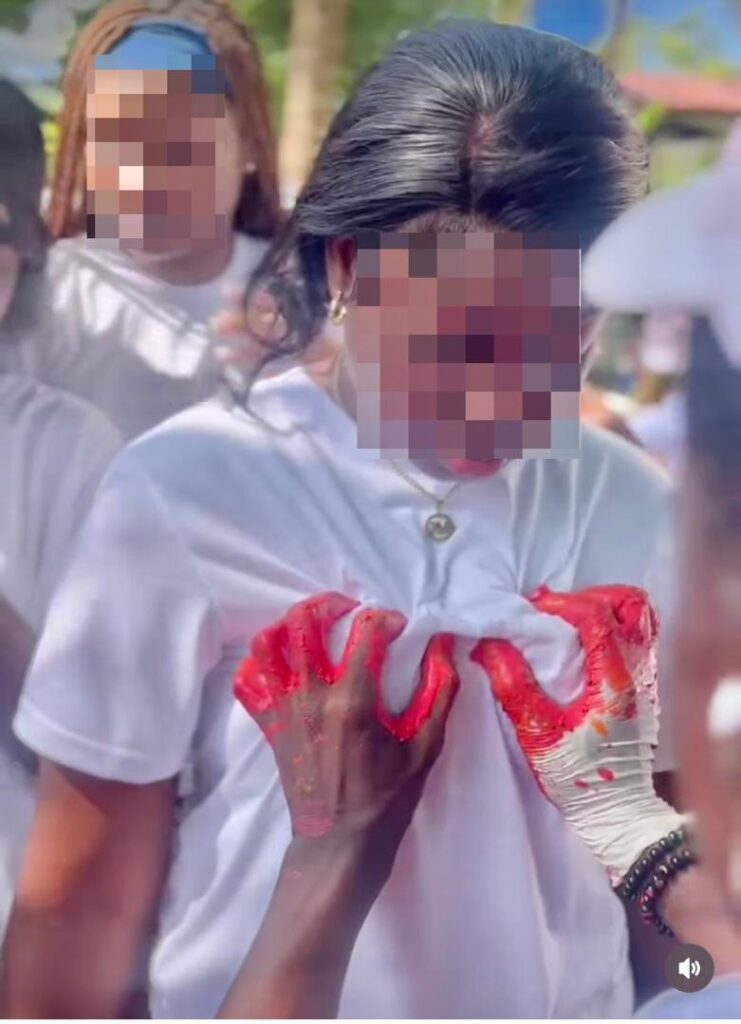 Une jeune fille victime d'attouchement sexuel.